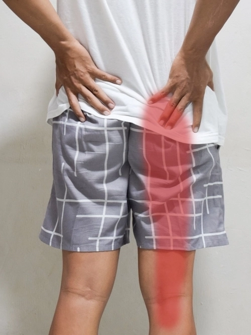 Stop Living with Sciatica. Get Expert, Non-Surgical Treatment That Targets the Source of Your Pain